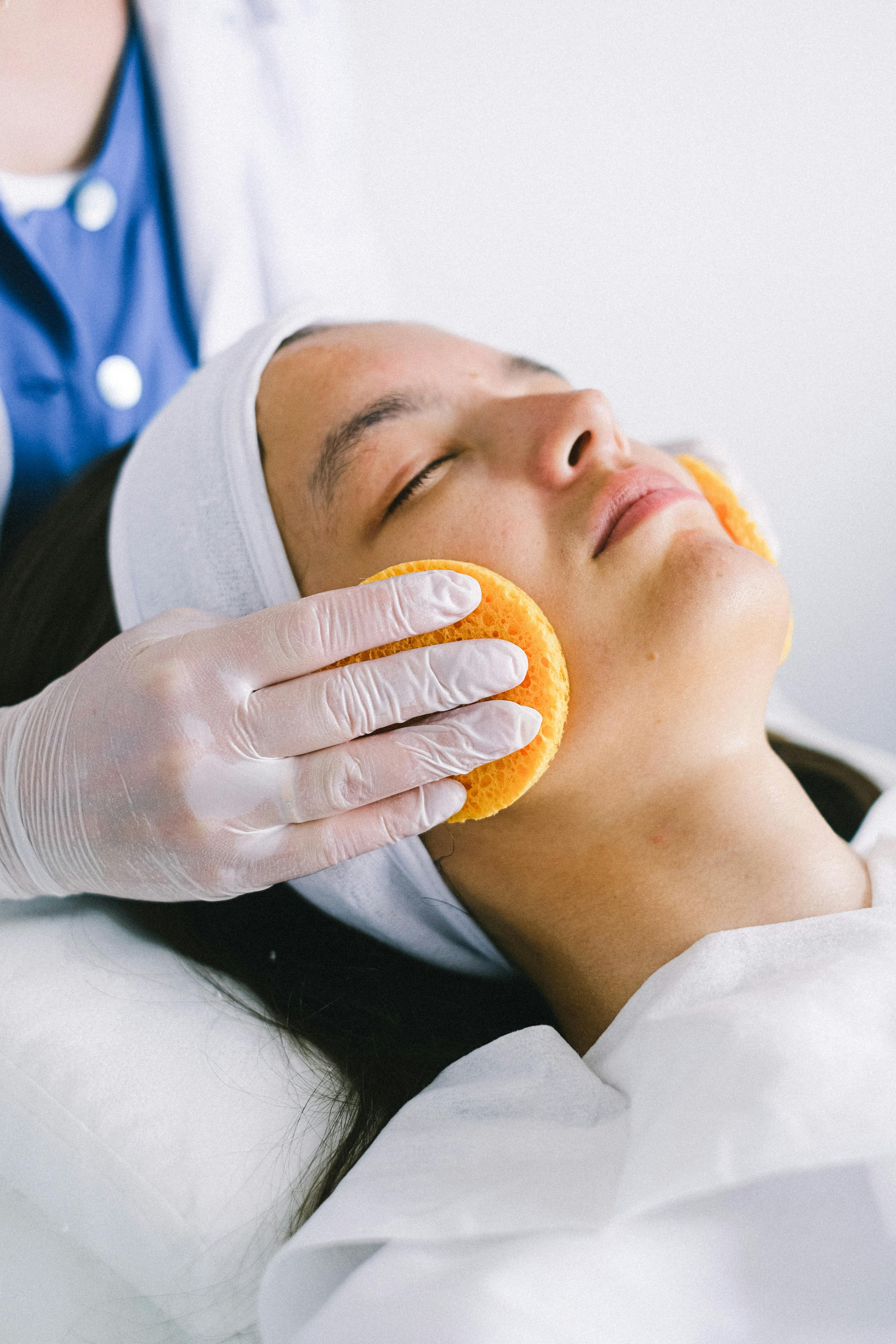 Microneedling with Chemical peel